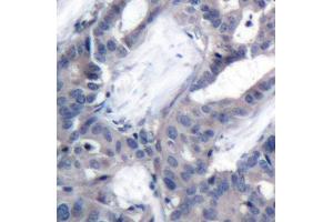 Immunohistochemistry (IHC) image for anti-Mitogen-Activated Protein Kinase Kinase 2 (MAP2K2) (pThr394) antibody (ABIN3019566) (MEK2 antibody  (pThr394))