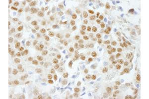 Immunohistochemistry (IHC) image for anti-General Transcription Factor IIIC, Polypeptide 5 (GTF3C5) (AA 469-519) antibody (ABIN7448588) (GTF3C5 antibody  (AA 469-519))