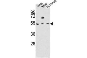 Western blot analysis of APOA4 antibody and Jurkat, K562, NCI-H460 lysate