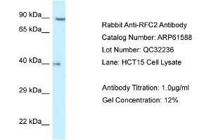Western Blotting (WB) image for anti-Replication Factor C (Activator 1) 2, 40kDa (RFC2) (N-Term) antibody (ABIN2788844) (RFC2 antibody  (N-Term))