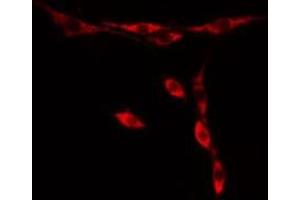 Immunofluorescence (fixed cells) (IF/ICC) image for anti-Parkinson Protein 7 (PARK7) (C-Term) antibody (ABIN6264038)