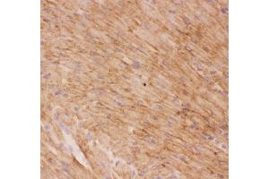 Anti-GLUT4 Picoband antibody,  IHC(F): Rat Cardiac Muscle Tissue (GLUT4 antibody  (AA 333-509))