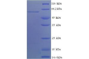 SDS-PAGE (SDS) image for Apolipoprotein A-IV (APOA4) (AA 21-396) protein (His-SUMO Tag) (ABIN5709057)