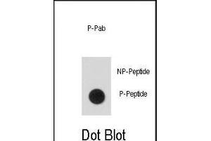 Dot blot analysis of anti-Phospho-hSTAT5a-p Phospho-specific Antibody (ABIN389667 and ABIN2839646) on nitrocellulose membrane.