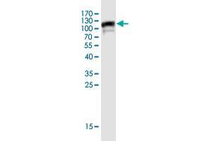 Western Blot detection against Immunogen (102 KDa) . (SHCBP1 antibody  (AA 1-672))
