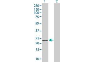 Western Blot analysis of MND1 expression in transfected 293T cell line by MND1 MaxPab polyclonal antibody. (MND1 antibody  (AA 1-205))