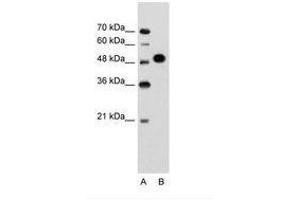 Image no. 1 for anti-Makorin Ring Finger Protein 1 (MKRN1) (AA 101-150) antibody (ABIN203479) (MKRN1 antibody  (AA 101-150))