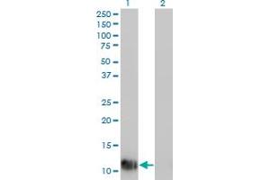 Western Blot analysis of FABP1 expression in transfected 293T cell line by FABP1 monoclonal antibody (M01), clone 4G5. (FABP1 antibody  (AA 1-127))