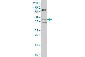 SCAP2 polyclonal antibody (A01), Lot # 050921JC01. (SKAP2 antibody  (AA 1-359))