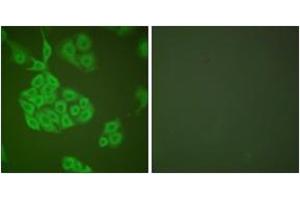 Immunofluorescence analysis of A549 cells, using MMP-11 Antibody. (MMP11 antibody  (AA 61-110))