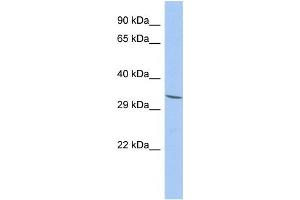 Western Blotting (WB) image for anti-Family with Sequence Similarity 78, Member A (FAM78A) antibody (ABIN2459899) (FAM78A antibody)