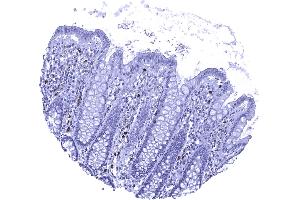 Colon descendes mucosa In the normal colon MPO positive granulocytes occur within small capillaries and also the stroma of the lamina propria (Myeloperoxidase antibody)