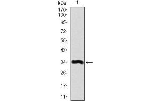 Western blot analysis using LPA antibody against human LPA recombinant protein. (Lp(a) antibody  (AA 4330-4521))