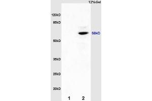 L1 mouse kidney lysates L2 mouse brain lysates probed with Anti ER-beta Polyclonal Antibody, Unconjugated (ABIN725210) at 1:200 overnight at 4 °C. (ESR2 antibody  (AA 201-300))