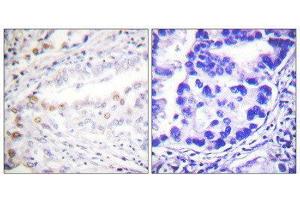 Immunohistochemistry (IHC) image for anti-SUMO1 Activating Enzyme Subunit 2 (UBA2) (C-Term) antibody (ABIN1848872) (UBA2 antibody  (C-Term))