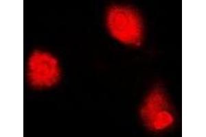 Immunofluorescent analysis of MTAP staining in Hela cells. (MTAP antibody)