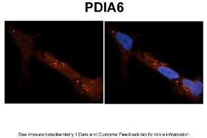 Sample Type: NT2 cells Red: Antibody Blue: DAPI Primary Dilution: 1ug/50ul antibody Secondary Antibody: Alexa goat anti-rabbit 594 Image Submitted by: Yuzhi Chen, University of Arkansas for Medical Sciences (PDIA6 antibody  (N-Term))