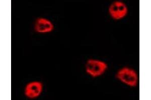 ABIN6277682 staining HepG2 by IF/ICC. (PIAS2 antibody  (N-Term))