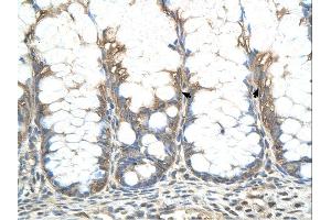 Immunohistochemistry (IHC) image for anti-Cysteine-Rich Hydrophobic Domain 2 (CHIC2) (N-Term) antibody (ABIN2782770) (CHIC2 antibody  (N-Term))