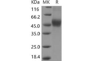Western Blotting (WB) image for Interleukin 2 Receptor, beta (IL2RB) protein (His tag) (ABIN7196470) (IL2 Receptor beta Protein (His tag))