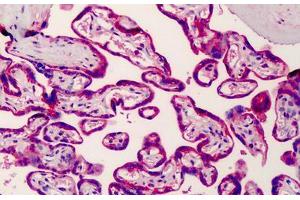 Human Placenta: Formalin-Fixed, Paraffin-Embedded (FFPE) (SREBF2 antibody  (AA 434-483))
