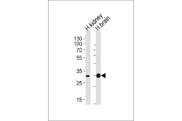 PRRG3 anticorps  (AA 121-150)