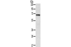 Gel: 8 % SDS-PAGE, Lysate: 40 μg, Lane: Human fetal brain tissue, Primary antibody: ABIN7192841(TNK1 Antibody) at dilution 1/400, Secondary antibody: Goat anti rabbit IgG at 1/8000 dilution, Exposure time: 5 minutes (TNK1 antibody)