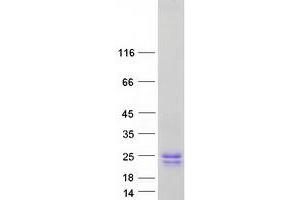 Validation with Western Blot