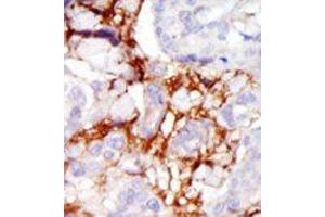 Image no. 2 for anti-PAK3 (PAK3) (Middle Region) antibody (ABIN360320) (PAK3 antibody  (Middle Region))