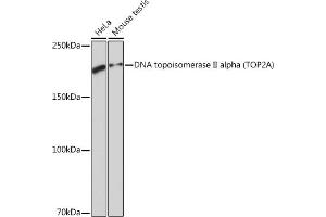 Western blot analysis of extracts of various cell lines, using DNA DNA topoisomerase II alpha (TOP2A) (TOP2A) Rabbit mAb (ABIN7270852) at 1:1000 dilution. (Topoisomerase II alpha antibody)
