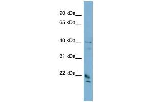 WB Suggested Anti-DYDC1 Antibody Titration: 0. (DYDC1 antibody  (Middle Region))