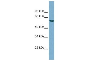 WB Suggested Anti-HHAT Antibody Titration:  0. (HHAT antibody  (N-Term))