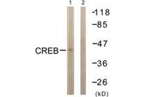 Western blot analysis of extracts from HeLa cells, treated with Insulin 0. (CREB1 antibody  (AA 91-140))