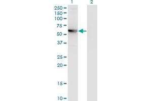 Western Blot analysis of CCDC83 expression in transfected 293T cell line by MGC34732 monoclonal antibody (M01), clone 3E3. (CCDC83 antibody  (AA 341-444))