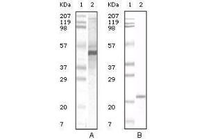 Western blot analysis using Apoa5 mouse mAb against human serum (A) and Apoa5 recombinant protein (B).