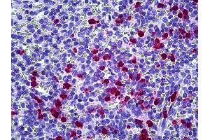 Anti-CAMP antibody IHC of human spleen, neutrophils. (Cathelicidin antibody)