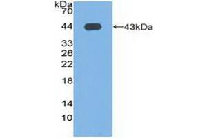Detection of Recombinant PLD, Human using Polyclonal Antibody to Phospholipase D (PLD) (Phospholipase D antibody  (AA 725-1074))
