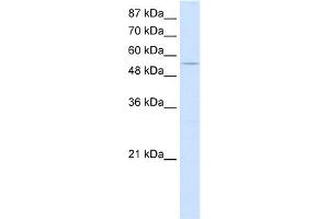 WB Suggested Anti-GTF3C5 Antibody Titration:  0. (GTF3C5 antibody  (C-Term))