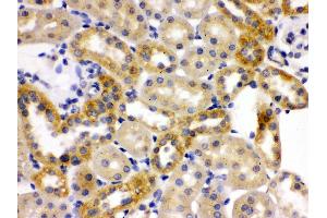 Anti- OPA1 Picoband antibody, IHC(P) IHC(P): Rat Kidney Tissue (OPA1 antibody  (C-Term))