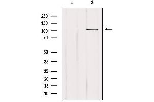 MTHFD1L antibody  (C-Term)