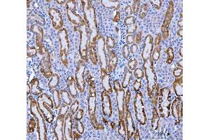 IHC analysis of KMO using anti-KMO antibody (ABIN7600958). (KMO antibody  (AA 26-372))