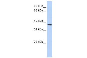 FBXO8 antibody used at 1 ug/ml to detect target protein. (FBXO8 antibody  (Middle Region))