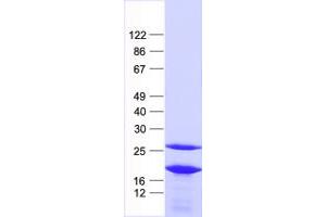 Validation with Western Blot (EIF1AX Protein (His tag))