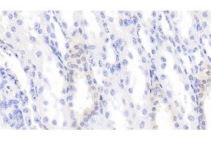 Detection of BMP3 in Bovine Kidney Tissue using Monoclonal Antibody to Bone Morphogenetic Protein 3 (BMP3) (BMP3 antibody  (AA 313-471))