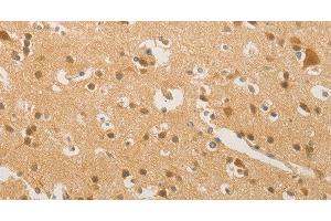 Immunohistochemistry of paraffin-embedded Human brain tissue using HIPK4 Polyclonal Antibody at dilution 1:30 (HIPK4 antibody)