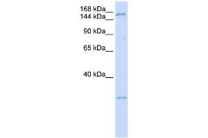 WB Suggested Anti-ZNF687 Antibody Titration:  0. (ZNF687 antibody  (C-Term))