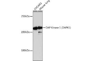 Western blot analysis of extracts of various cell lines, using DAP Kinase 1 (D) Rabbit mAb (ABIN7266711) at 1:1000 dilution. (DAP Kinase 1 antibody)