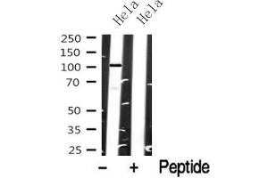Western blot analysis of EPHA8 in lysates of Hela, using EPHA8 Antibody(ABIN6272805). (EPH Receptor A8 antibody  (Internal Region))