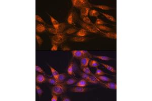Immunofluorescence analysis of NIH-3T3 cells using RheB Rabbit mAb (ABIN7269863) at dilution of 1:100 (40x lens). (RHEB antibody)