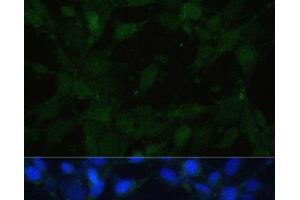 Immunofluorescence analysis of NIH/3T3 cells using TRPV1 Polyclonal Antibody at dilution of 1:100.